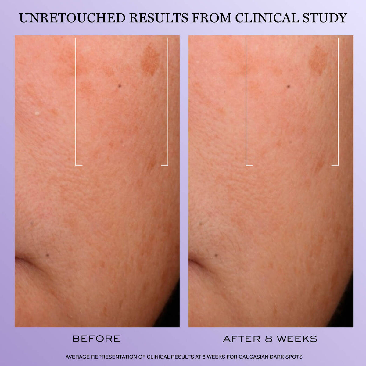Lancôme H.C.F. Triple Serum