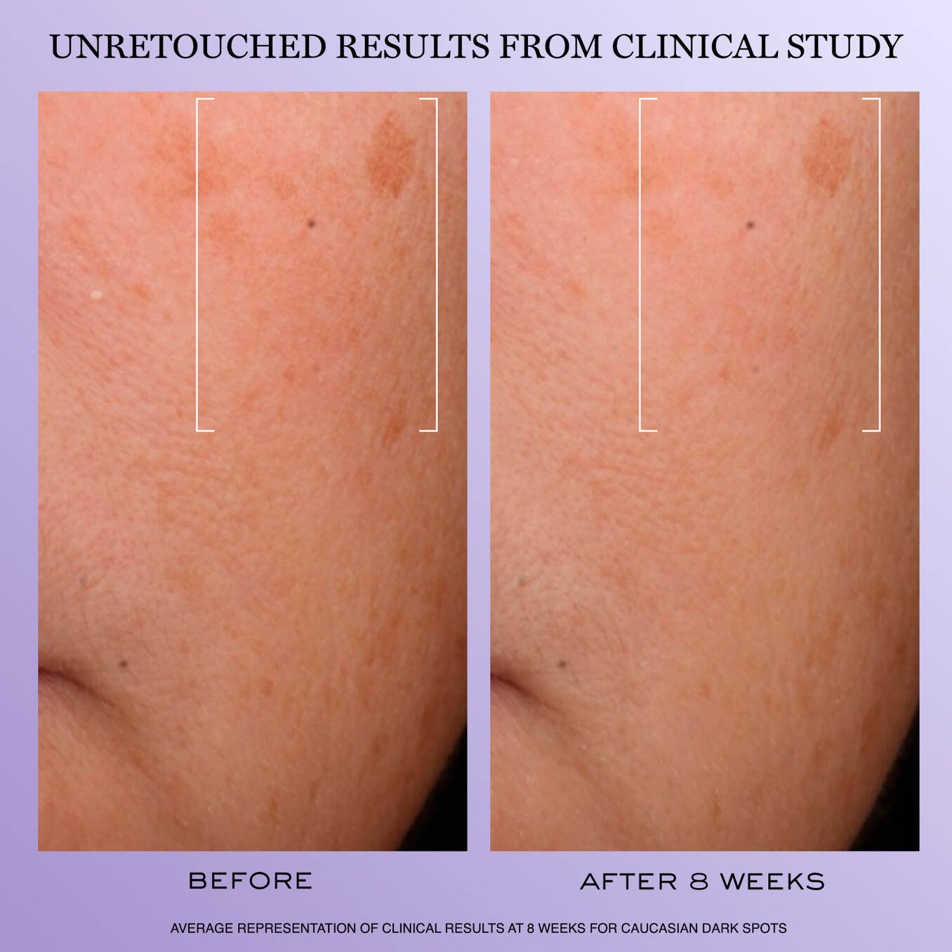 Lancôme Rénergie H.C.F. Triple Serum